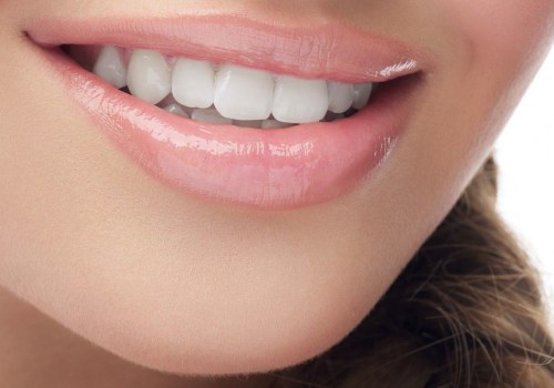 Can Porcelain Veneers Be Remodeled? An Expert's Perspective