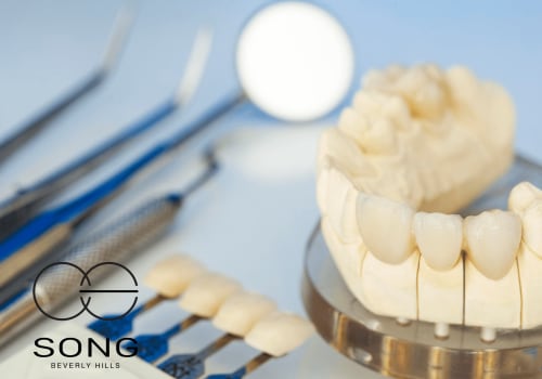 Porcelain Veneer-dentists-beverly-hills